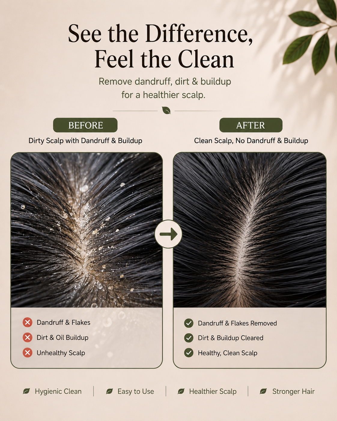 Brinsel Dandruff Removal Comb – Scalp & Hair Care